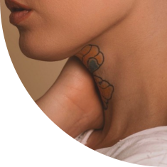 Image of a neck